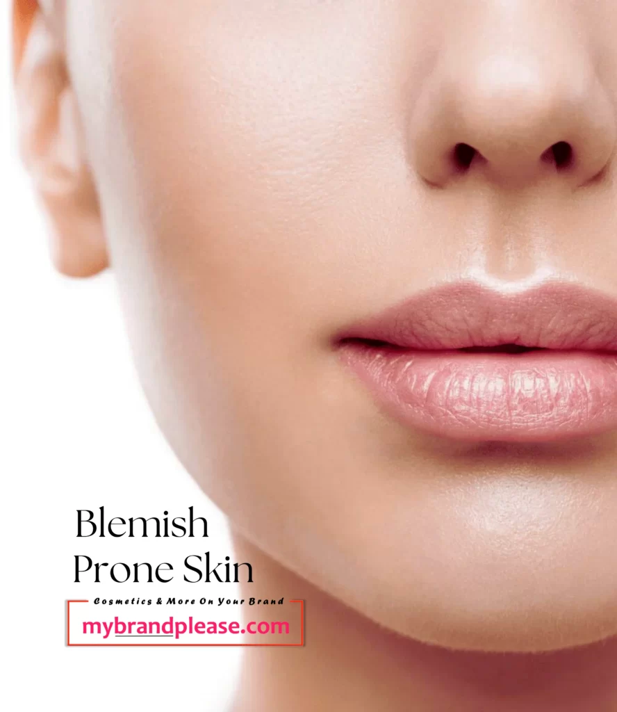 Blemish Prone Skin Care