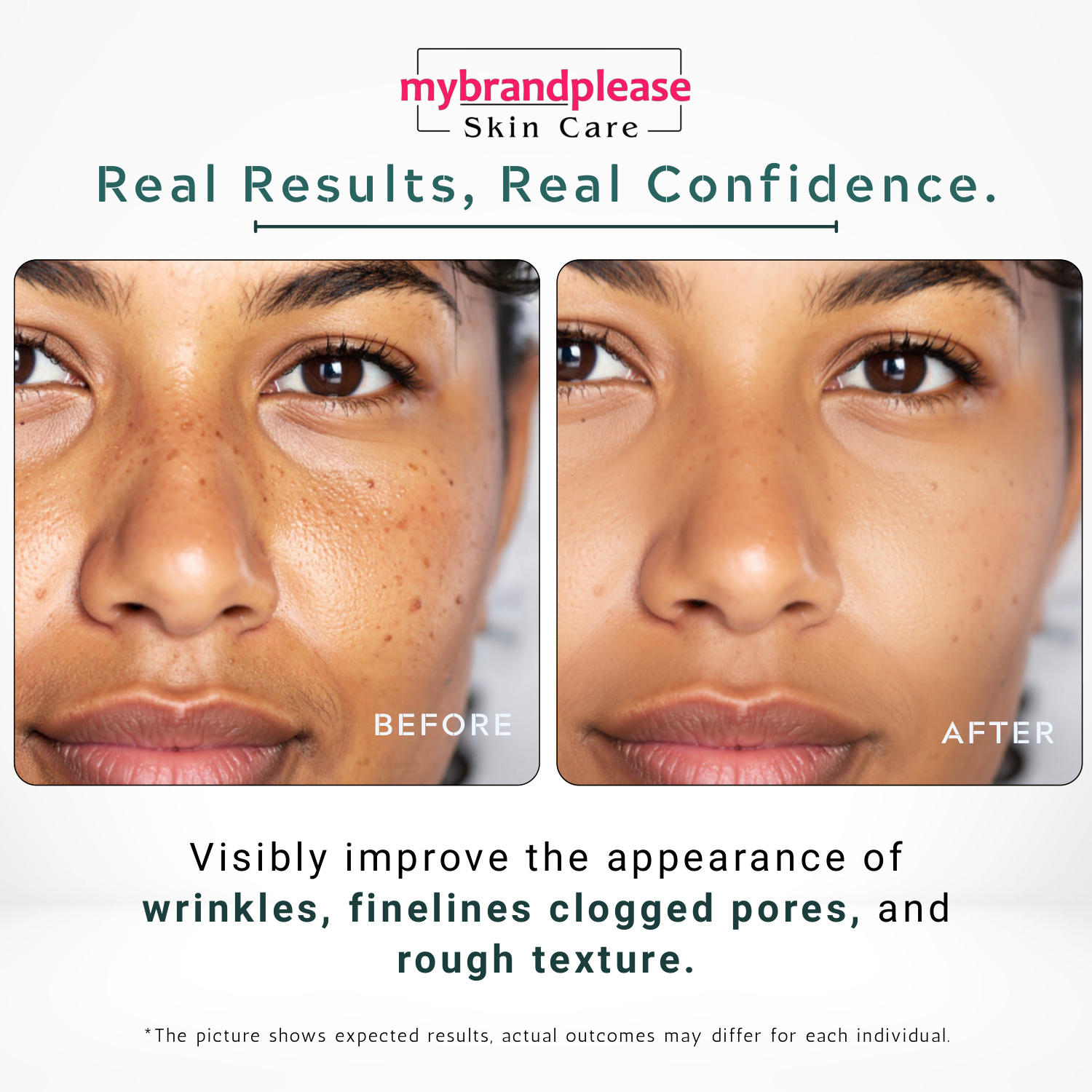 RETINOL