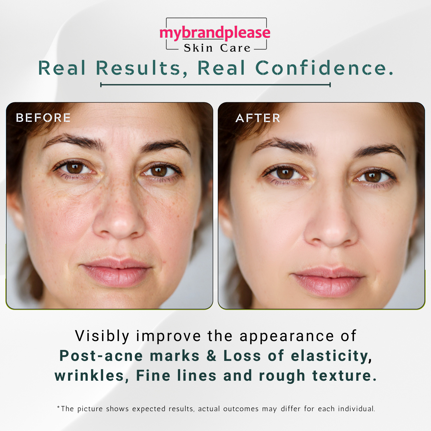 Alpha Arbutin 2 + Hyaluronic Acid 10