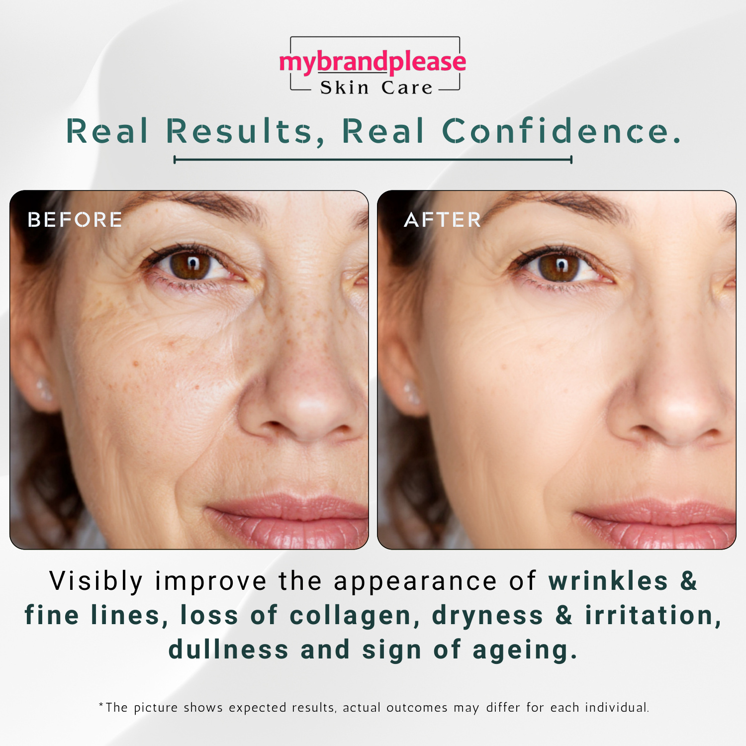 Retinol + Hyaluronic