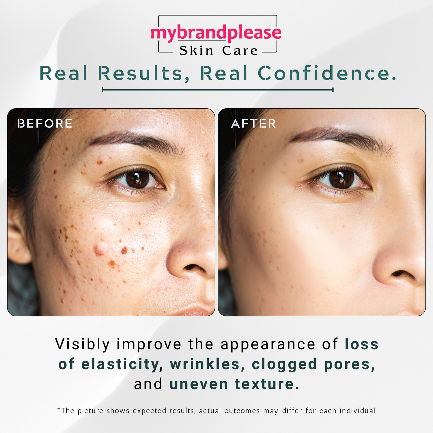 Squalene + Hyaluronic